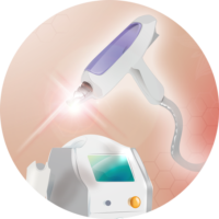 Grafik-YAG-Laser