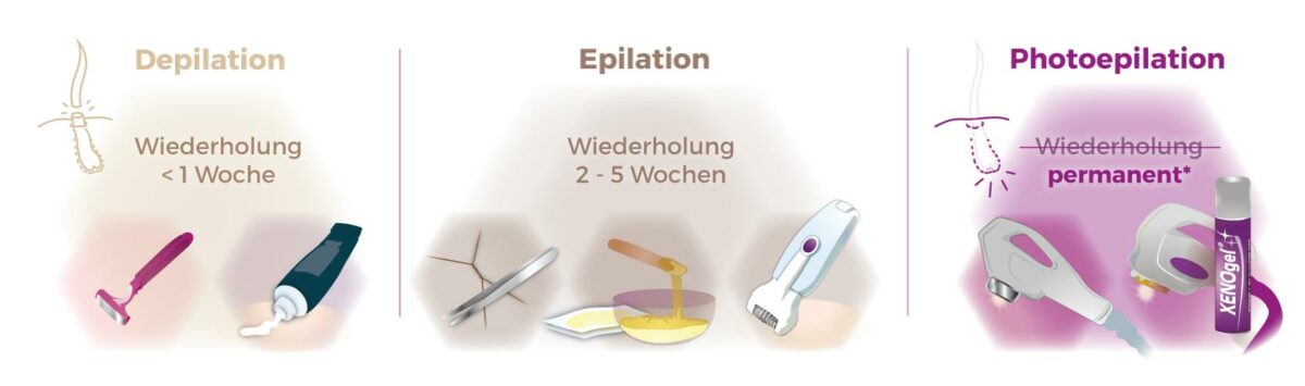 Vergleichsgrafik Haarentfernung