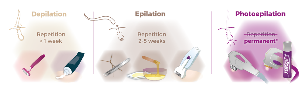 Hair removal comparison graphic
