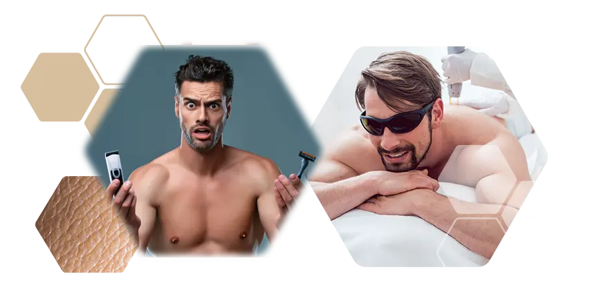 Photos man shaving annoys light and laser hair removal better