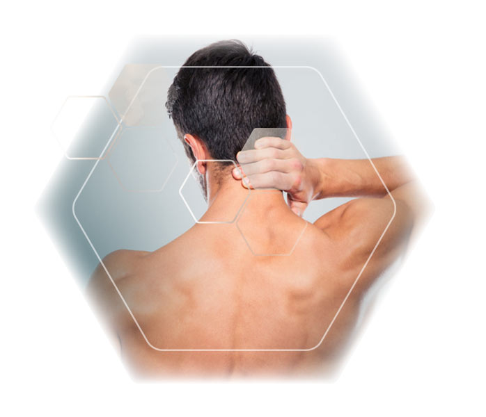 Körperregion Mann dauerhafte Haarentfernung Nacken Hals