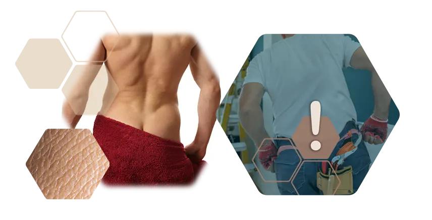 Photos upper pawl lower back Maurerdekolleté